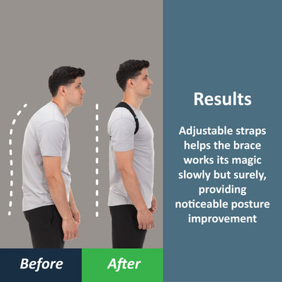 ComfyBrace Posture Corrector for Back Pain - Innovative design to relieve neck, shoulder, and back pain.